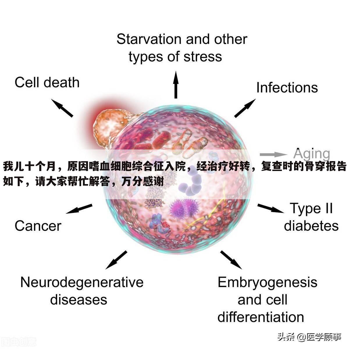 我儿十个月，原因嗜血细胞综合征入院，经治疗好转，复查时的骨穿报告如下，请大家帮忙解答，万分感谢